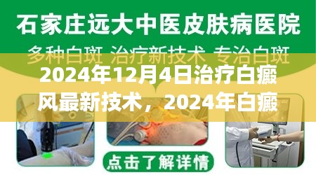 2024年白癜風治療最新技術(shù)解讀與應(yīng)用前景展望，革新與未來趨勢