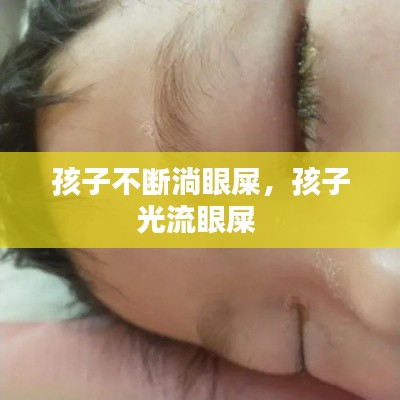 孩子不斷淌眼屎，孩子光流眼屎 