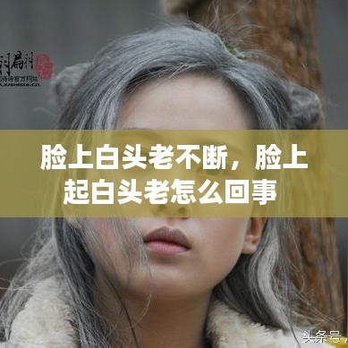 臉上白頭老不斷，臉上起白頭老怎么回事 